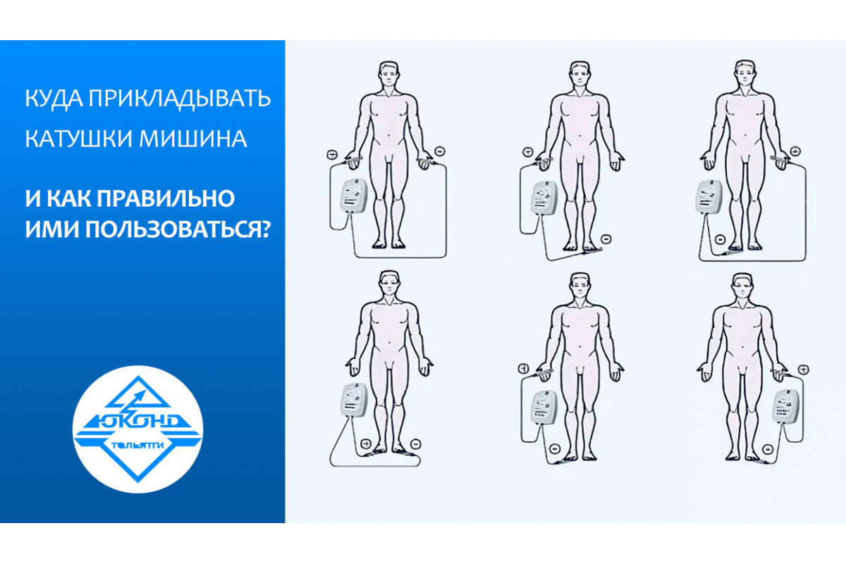 Куда прикладывать катушки Мишина и как правильно ими пользоваться? Куда прикладывать катушки Мишина и как правильно ими пользоваться?