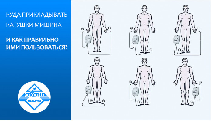 Куда прикладывать катушки Мишина и как правильно ими пользоваться? Куда прикладывать катушки Мишина и как правильно ими пользоваться?